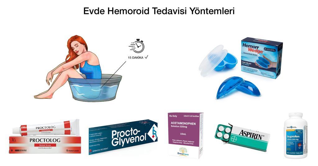 Evde Hemoroid Tedavisi Yöntemleri