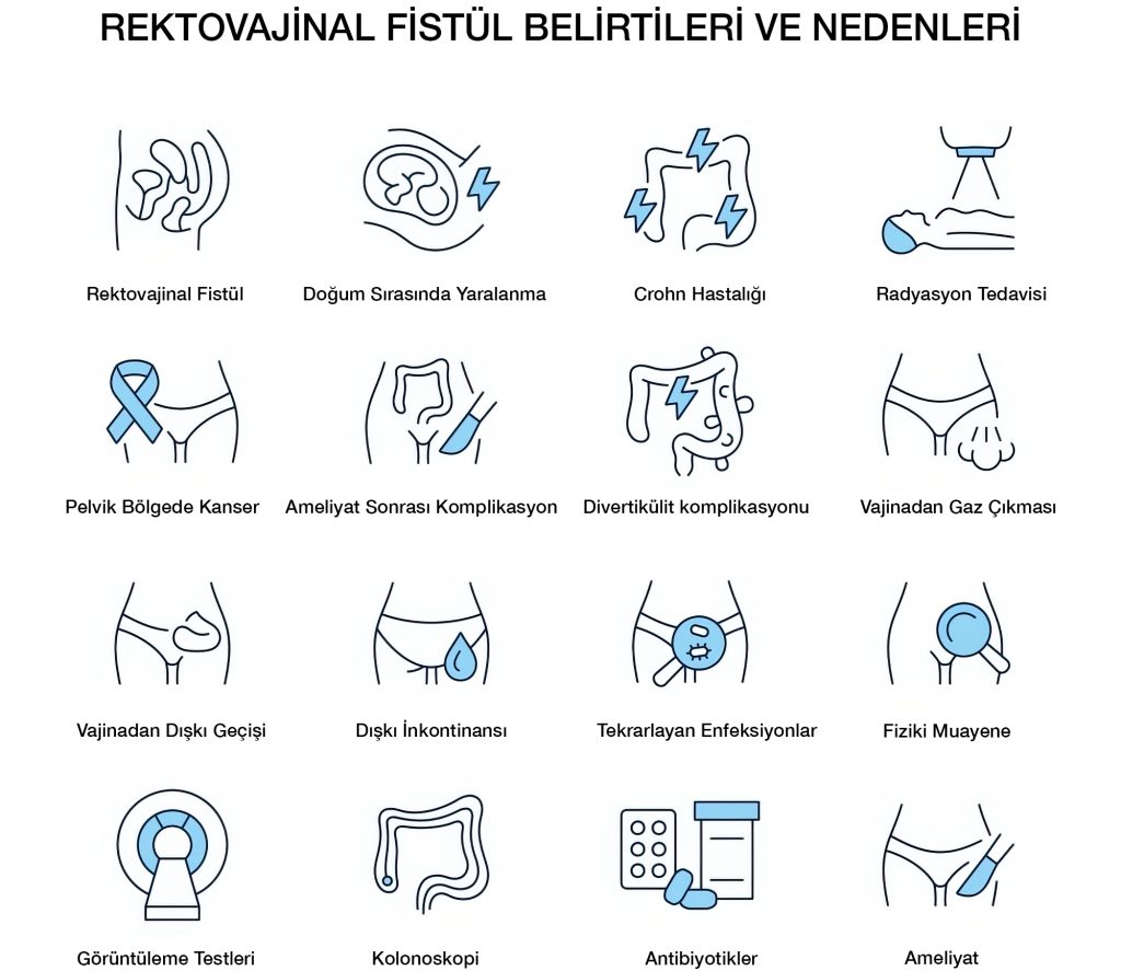 Rektovajinal Fistül Belirtileri