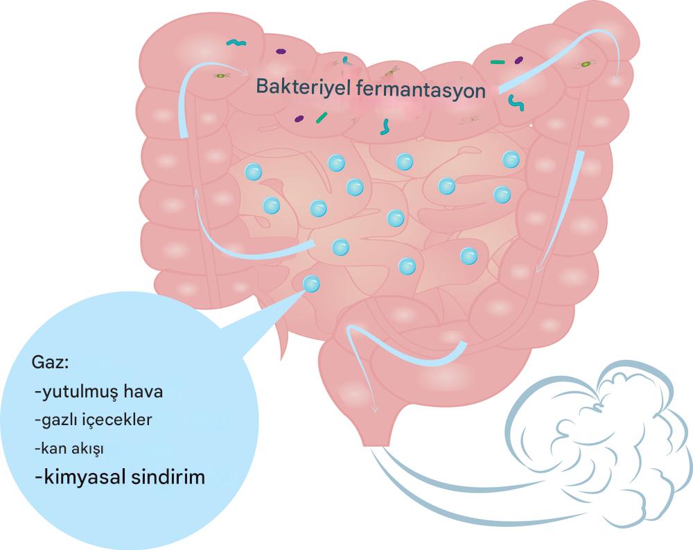 Aşırı Gaz Çıkarma Nedenleri ve Çözümleri