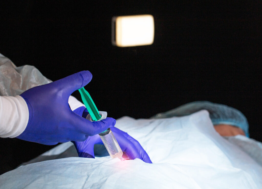 Makat Çatlağı Botoksu nasıl uygulanır