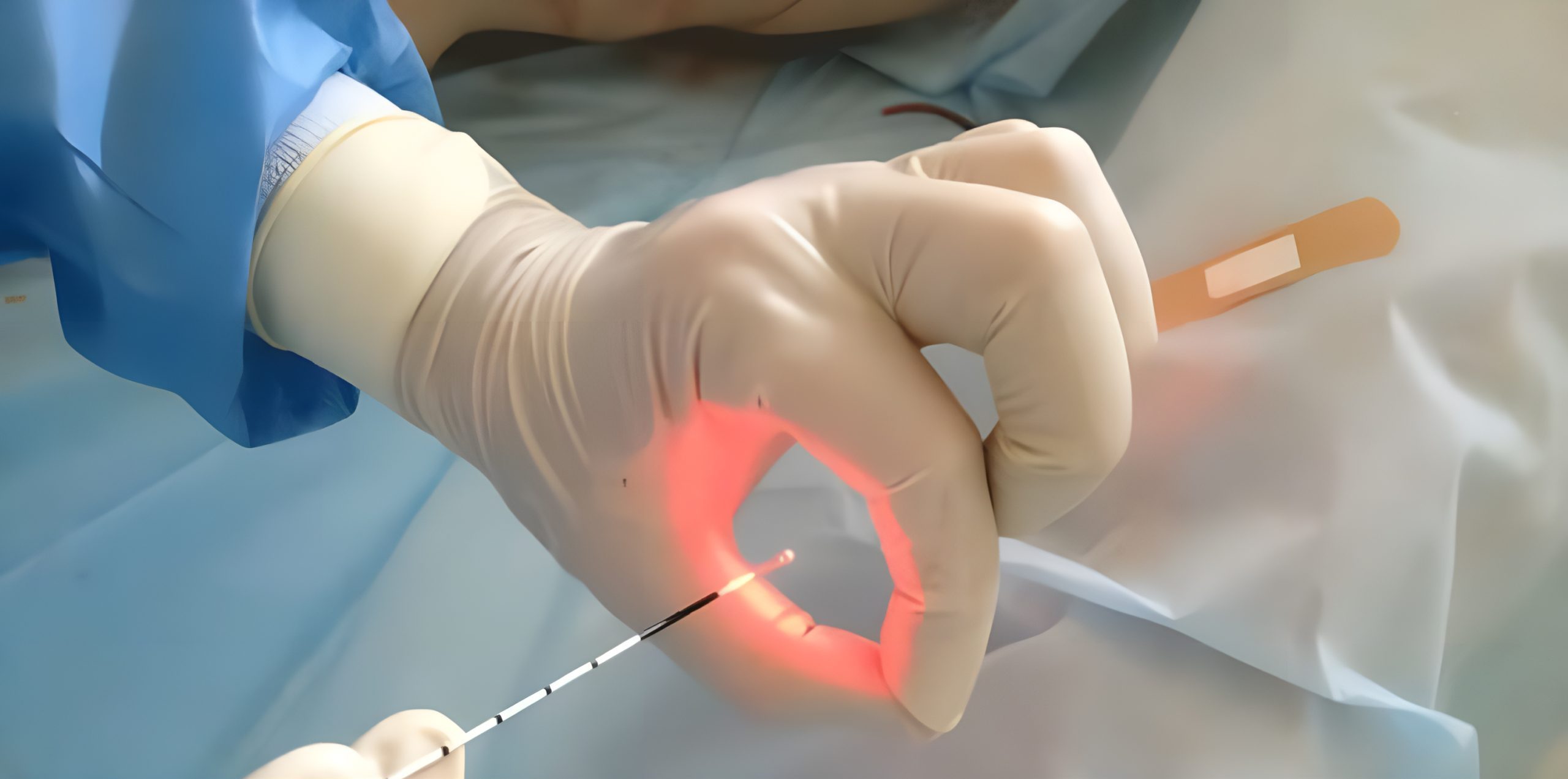 Lazerle Fistül Ameliyatı Nasıl Yapılır Op Dr Mustafa Göztok