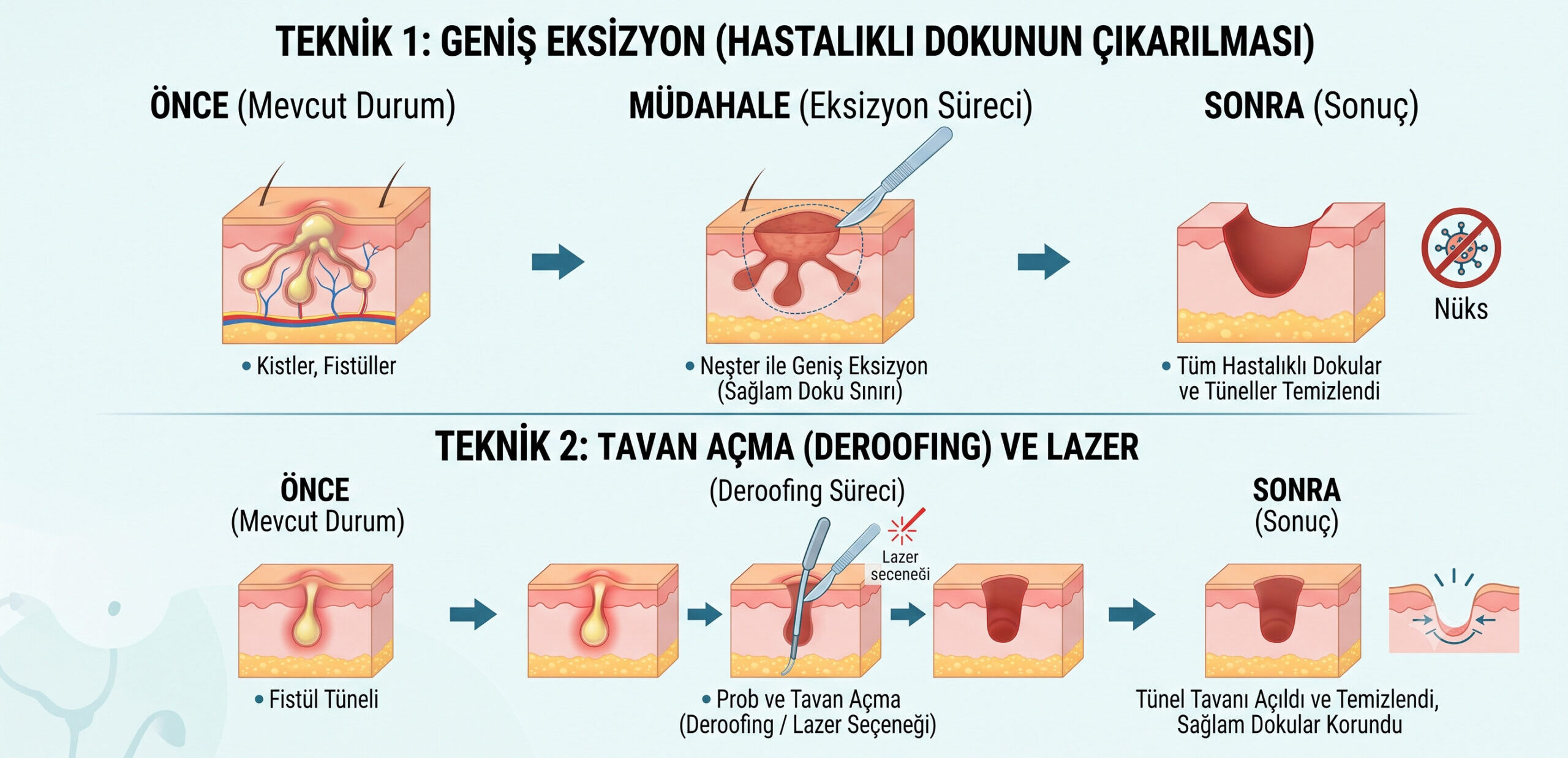 Köpek Memesi Hastalığı Ameliyatı Nasıl Yapılır